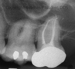 Post-Operative View